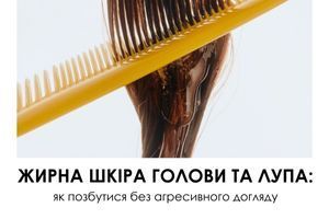 Жирна шкіра голови та лупа: як позбутися без агресивного догляду