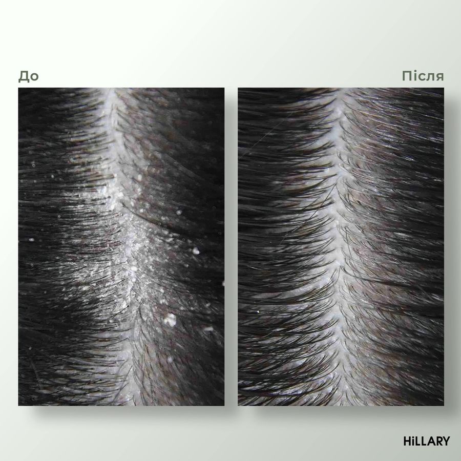 Энзимный пилинг для кожи головы + Набор для всех типов волос Hillary Intensive Nori Building and Strengthening - фото №1