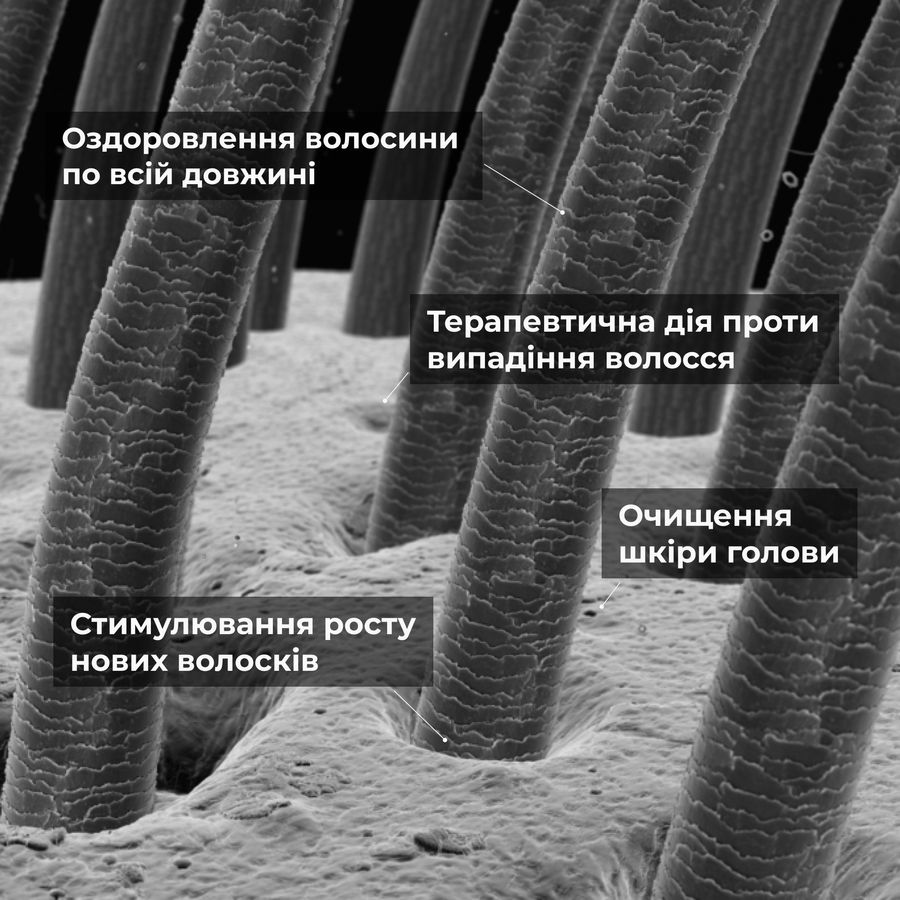 Шампунь та сироватка для волосся Concentrate Serenoa + кондиціонер проти випадіння волосся - фото №1