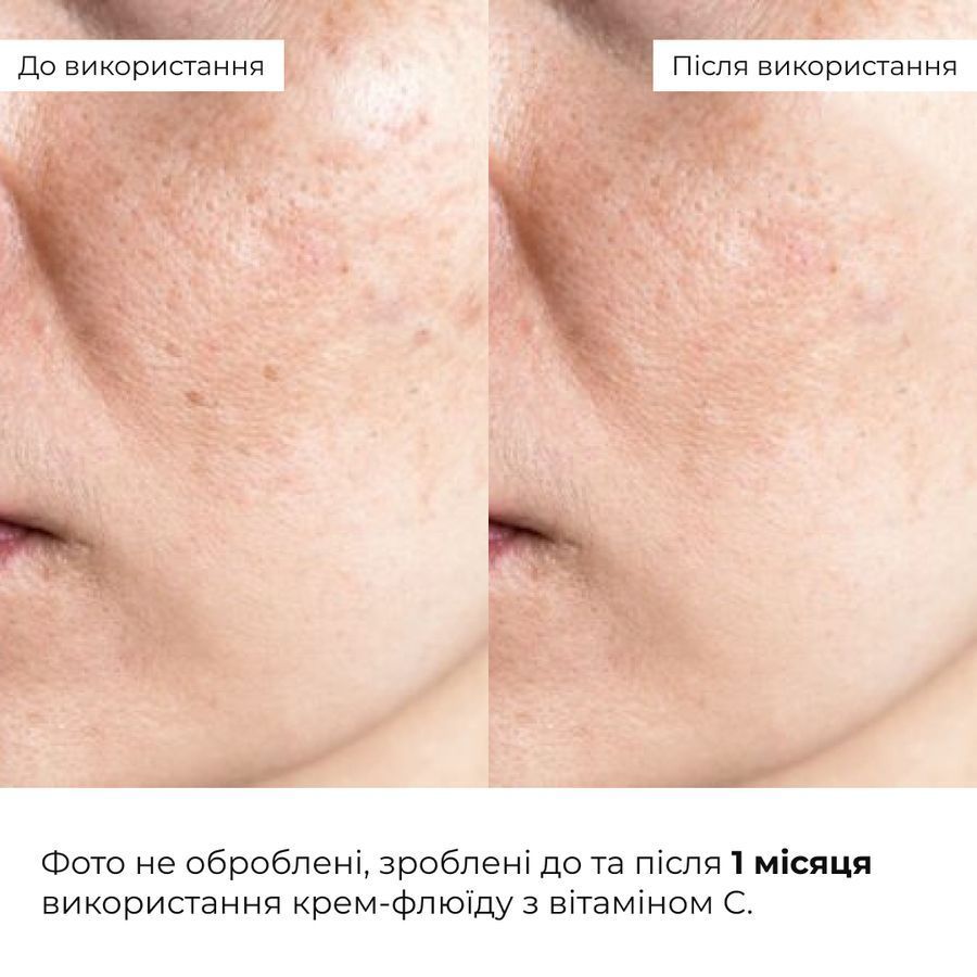 Комплекс для освітлення пігментації та захисту від фотостаріння Hillary Pigmentation Brightening & Photoaging Protection Complex - фото №1
