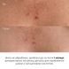 Комплекс для відлущування та корекції висипань на тілі Hillary Exfoliation & Body Acne Correction Complex - фото