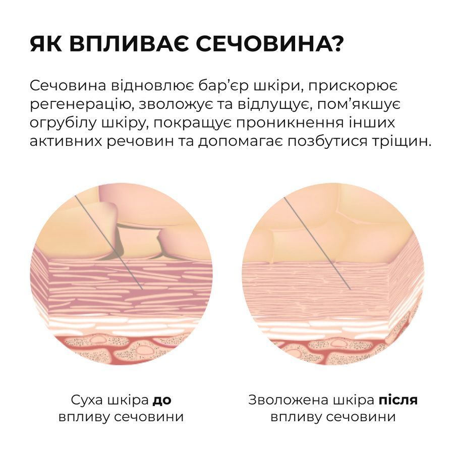 Комплекс для відлущування та корекції висипань на тілі Hillary Exfoliation & Body Acne Correction Complex - фото №1