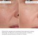 Комплекс для щоденного зволоження та рівного тону шкіри Hillary Daily Hydration & Even Skin Tone Complex - фото