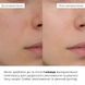 Комплекс для щоденного зволоження та рівного тону шкіри Hillary Daily Hydration & Even Skin Tone Complex - фото