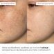 Комплекс для щоденного зволоження та рівного тону шкіри Hillary Daily Hydration & Even Skin Tone Complex - фото