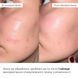Комплекс для щоденного зволоження та рівного тону шкіри Hillary Daily Hydration & Even Skin Tone Complex - фото