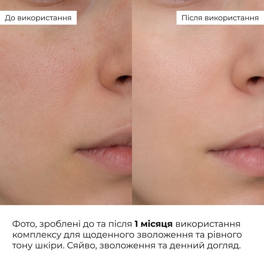 Комплекс для щоденного зволоження та рівного тону шкіри Hillary Daily Hydration & Even Skin Tone Complex - фото №1