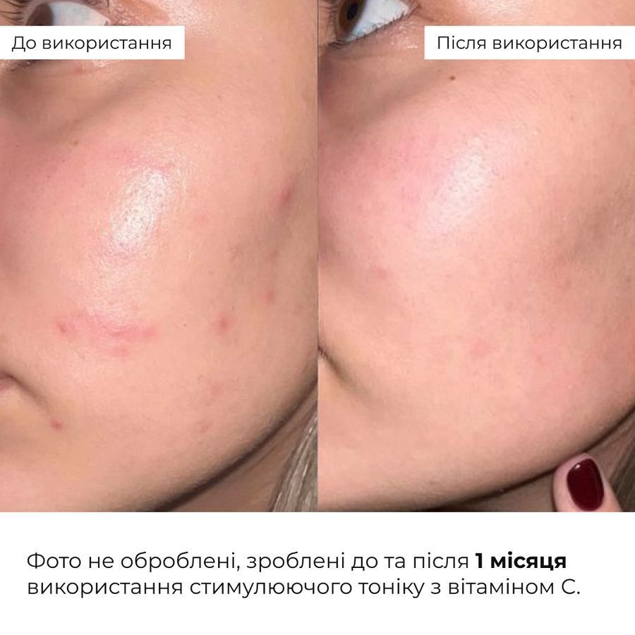 Комплекс для щоденного зволоження та рівного тону шкіри Hillary Daily Hydration & Even Skin Tone Complex - фото №1