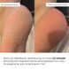 Набір для зволоження та пом'якшення потрісканих п&rsquo;ят Hillary Set for Moisturizing & Softening Cracked Heels - фото