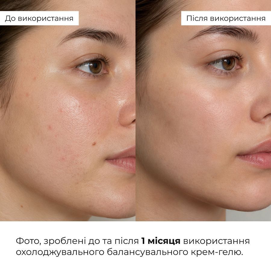 Набір для контролю жирного блиску та зменшення пор Hillary Oil Control & Pore-Minimizing Set - фото №1