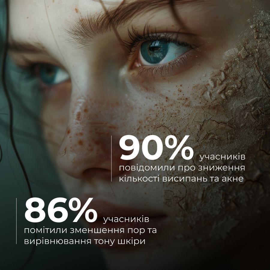 Hillary Acne Control & Detox Skin Kit