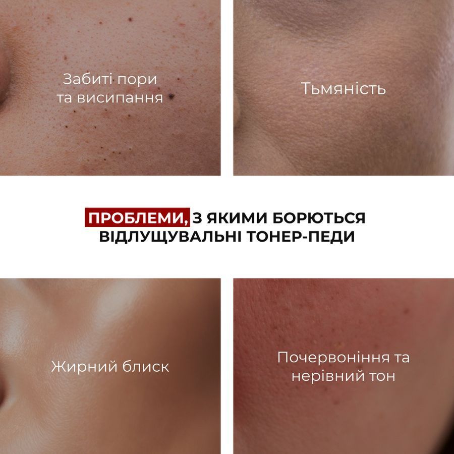 Комплекс для освітлення пігментних плям та захисту шкіри Hillary Dark Spot Brightening & Skin Protection Complex - фото №1