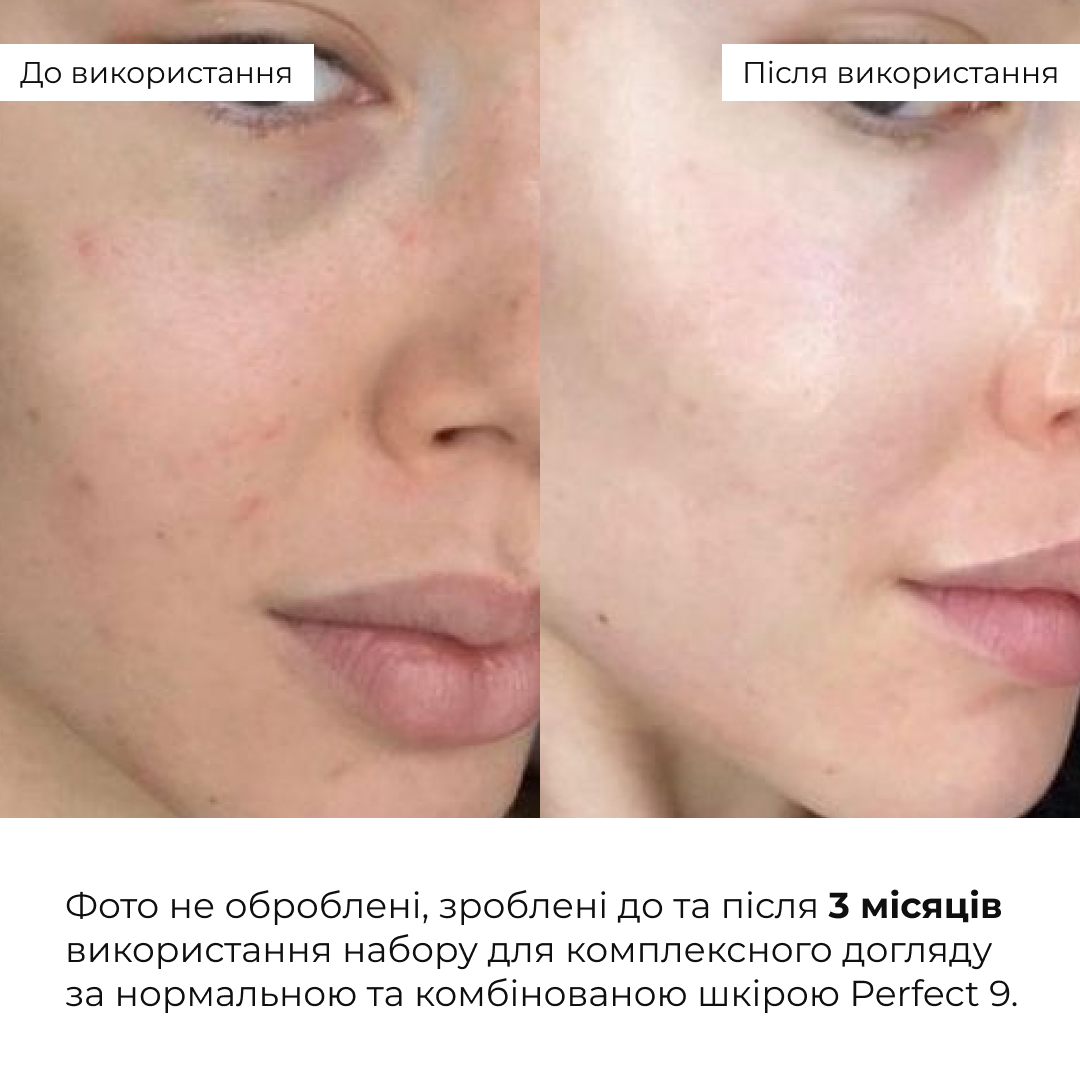 Набір для комплексного догляду за нормальною та комбінованою шкірою Hillary Perfect 9