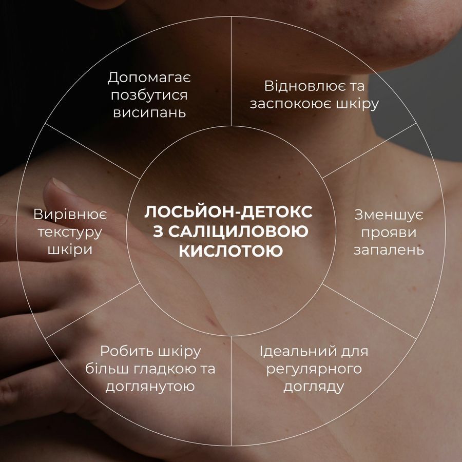 Комплекс для тіла проти акне з саліциловою кислотою Hillary Anti-Acne Body Care Complex with Salicylic Acid - фото №1