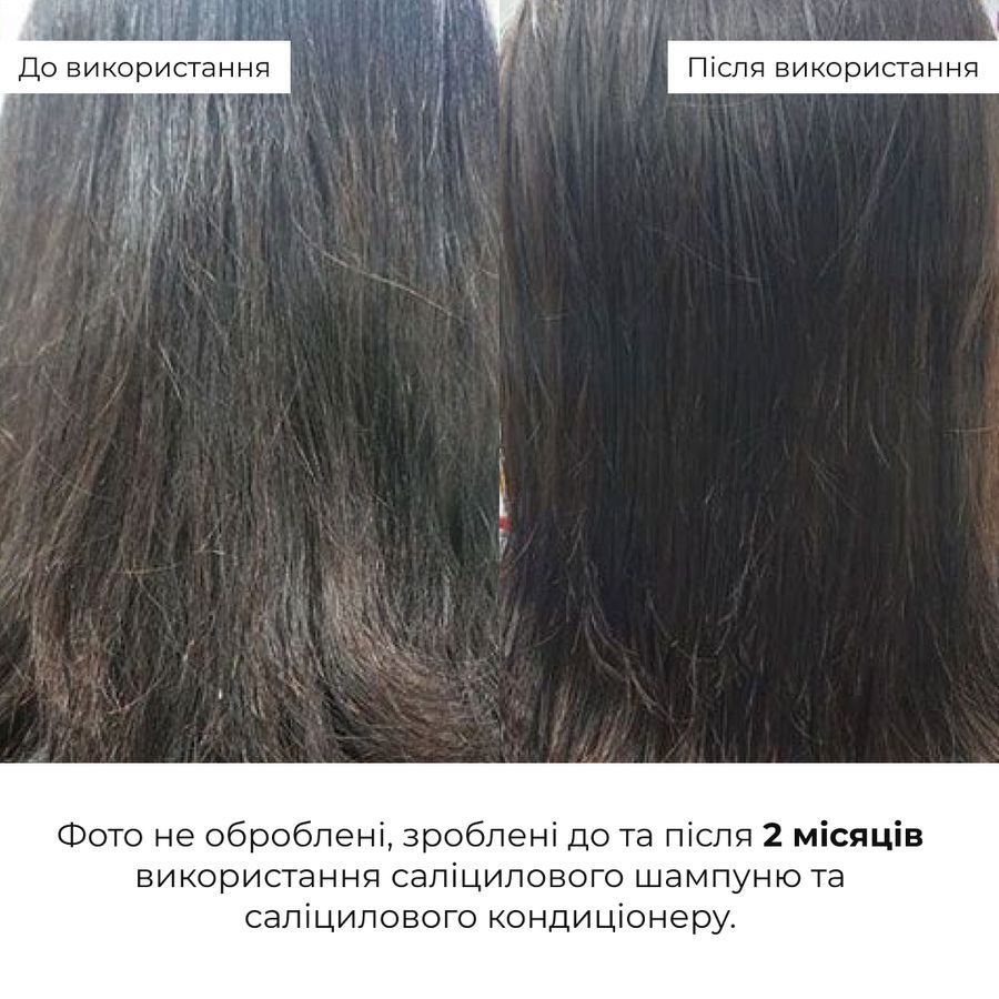 HILLARY Complex for Reducing Scalp Oiliness and Restoring Hair