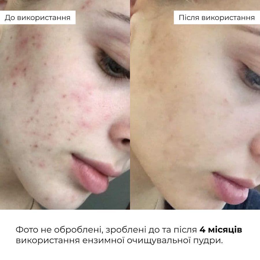 Hillary Enzyme Balance Cleanser Powder + Toner for normal and combination skin