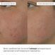 Hillary Pigmentation Brightening & Skin Protection Complex