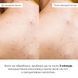 Hillary Body Acne Control & Sun Protection Complex