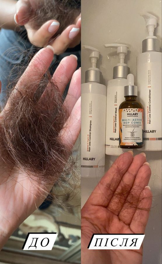 Шампунь + Кондиционер Шампунь против выпадения волос Hillary Serenoa & РР Hair Loss Control Shampoo - фото №1
