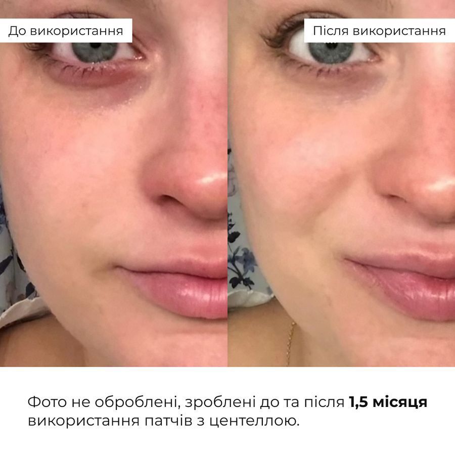 Набір із центеллою для заспокоєння та відновлення шкіри Hillary Centella Soothing & Recovery Set - фото №1