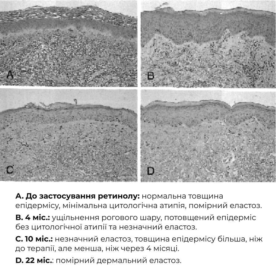 Комплекс глибокого нічного відновлення шкіри ReNuAge Retinol & Collagen Night Ritual - фото №1
