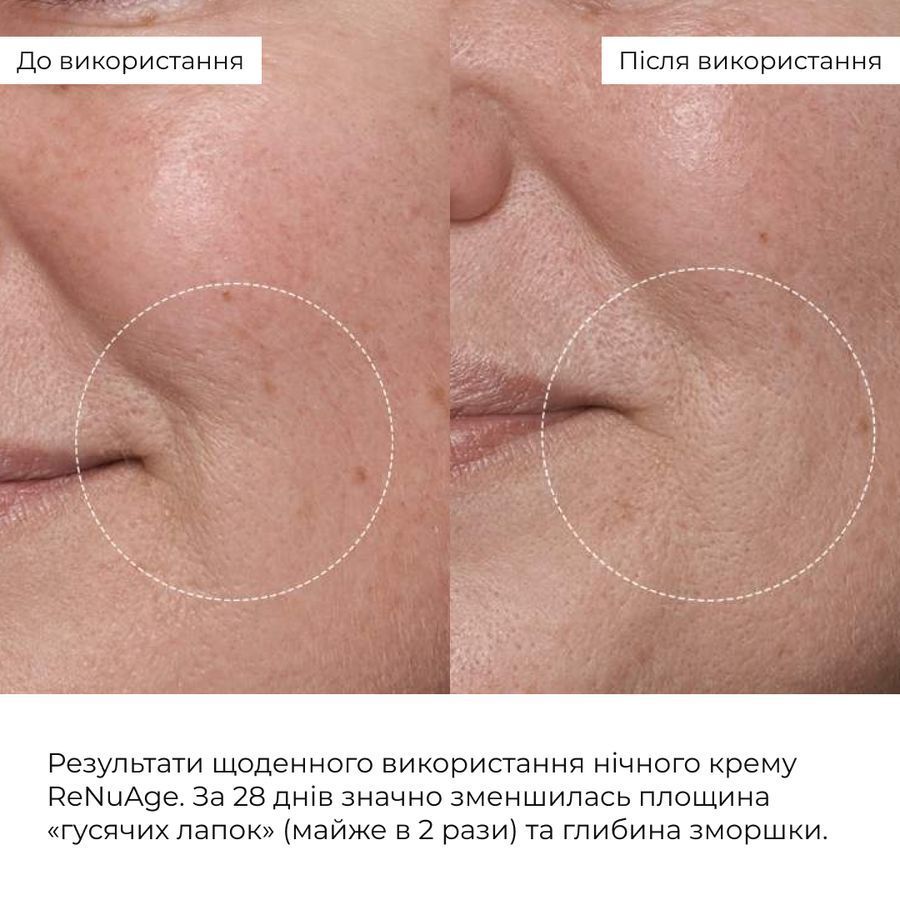 Комплекс глибокого нічного відновлення шкіри ReNuAge Retinol & Collagen Night Ritual - фото №1