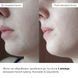 Spring care for dry skin types
