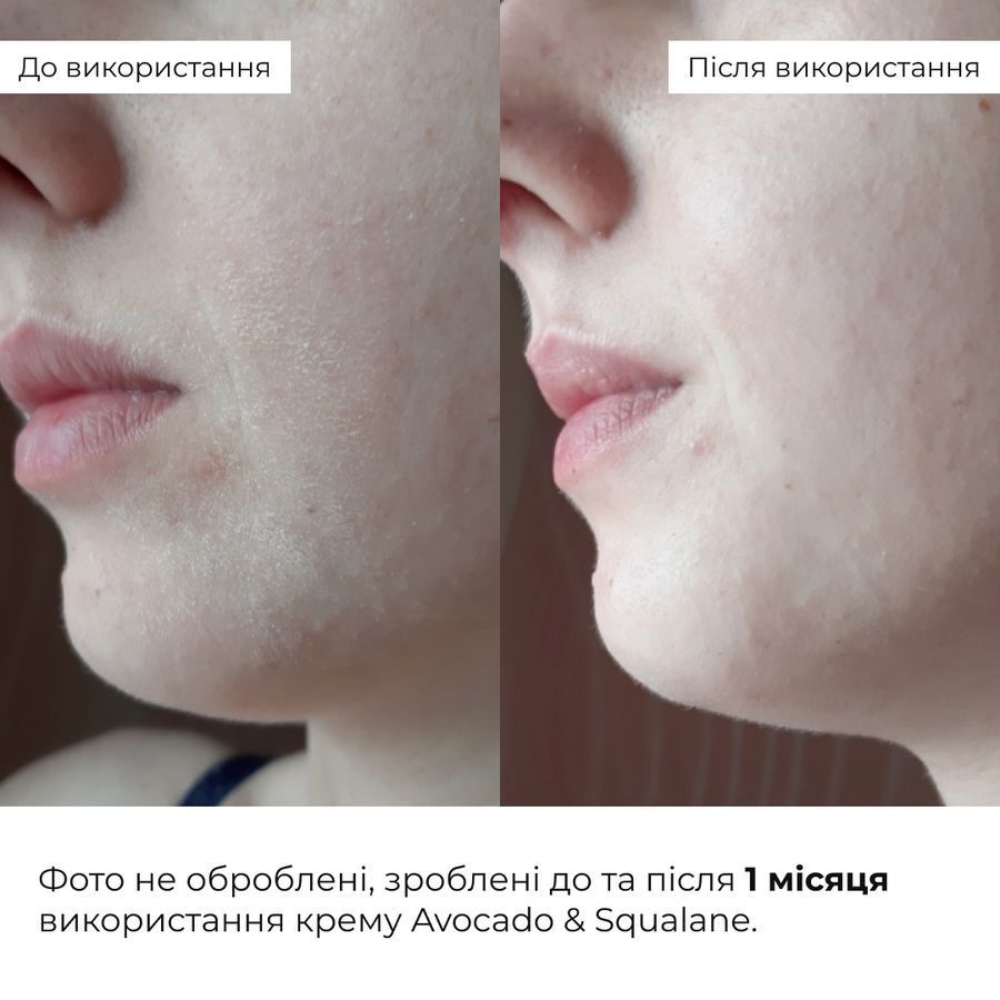 Spring care for dry skin types