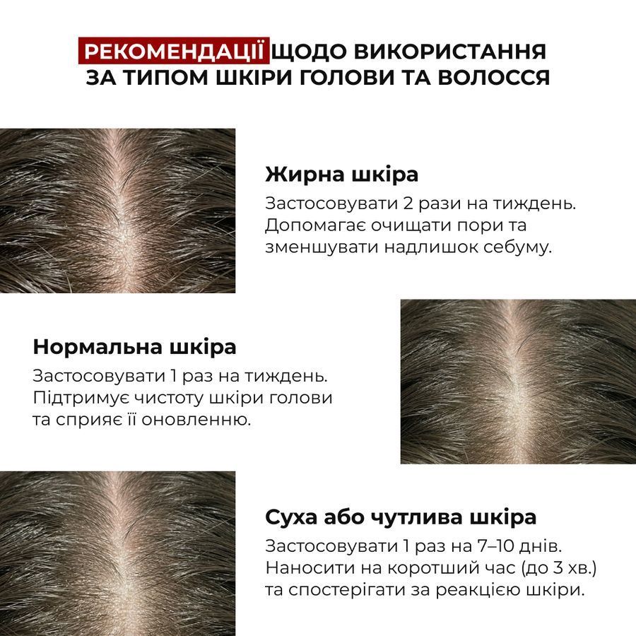 Комплекс для відновлення та зміцнення пошкодженого волосся HiLLARY - фото №1