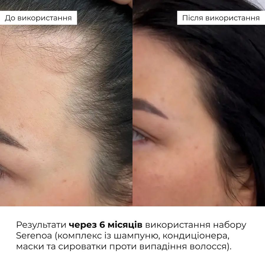 Маска проти випадіння волосся Hillary Serenoa & РР Hair Loss Control Mask, 200 мл - фото №1