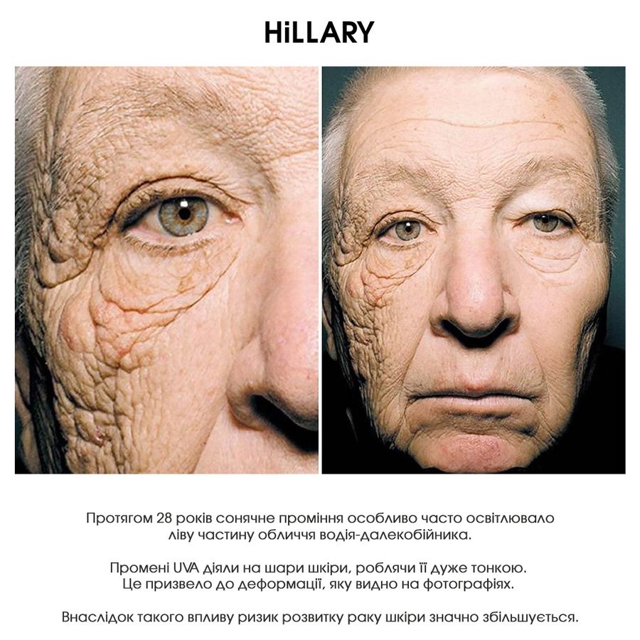 Набір для обличчя сонцезахисний та тонізуючий Hillary Sun protection and Toning - фото №1