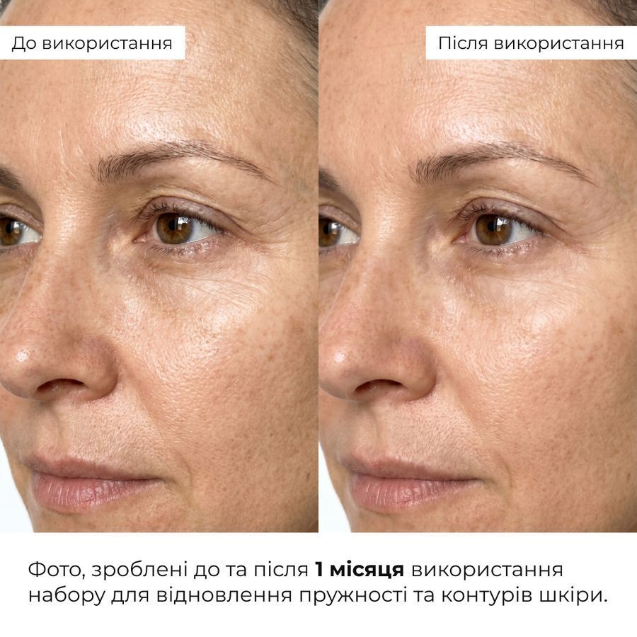 Набір для відновлення пружності та контурів шкіри & ReNuAge Exosome Collagen Contour Set - фото №1
