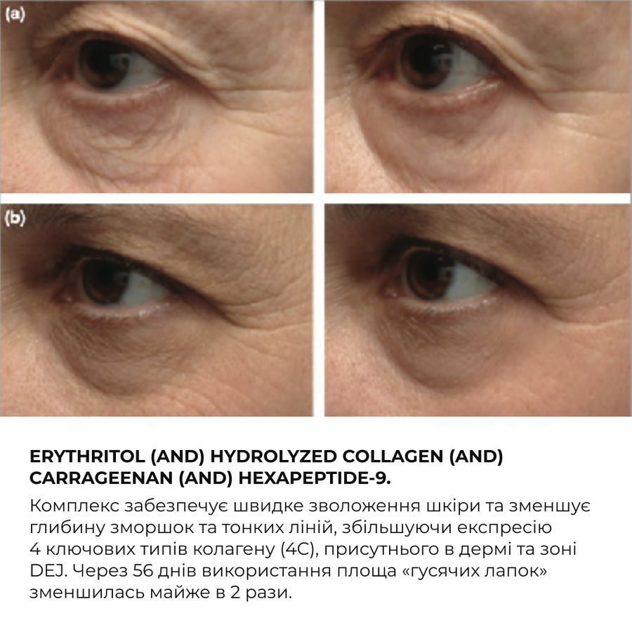 Набір для відновлення пружності та контурів шкіри & ReNuAge Exosome Collagen Contour Set - фото №1