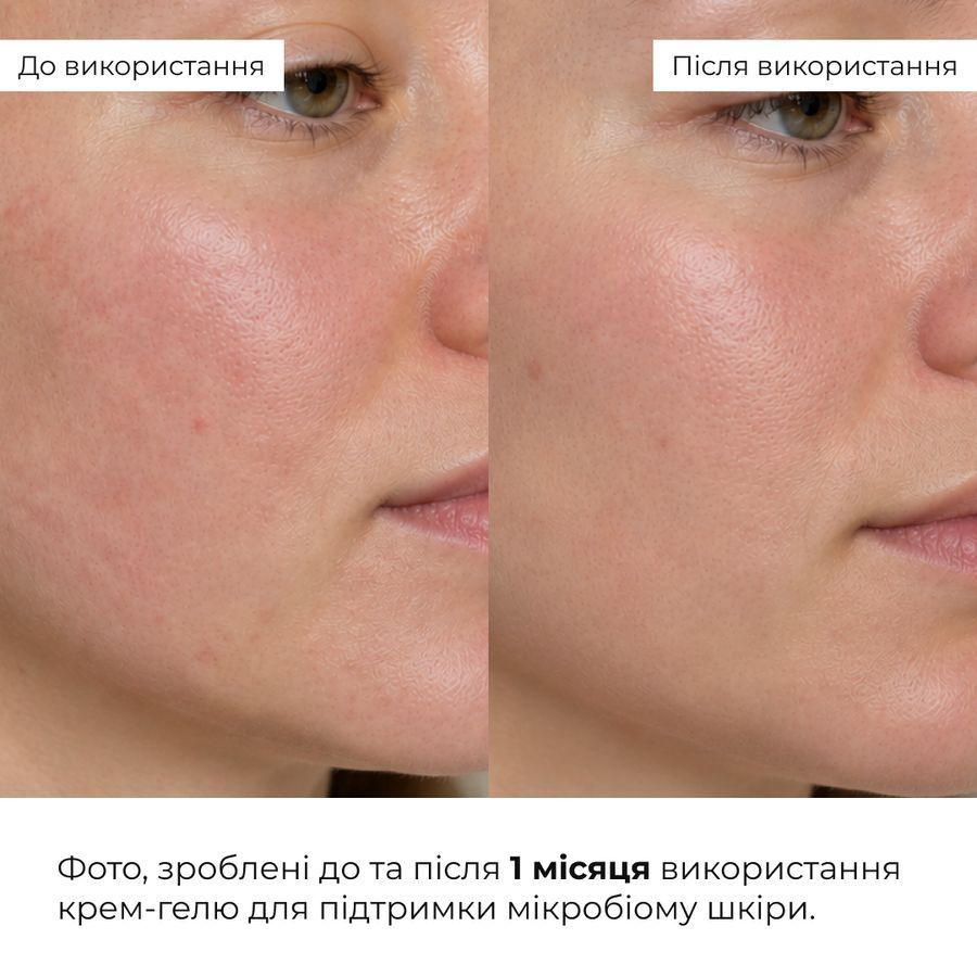 Комплекс для заспокоєння шкіри та зменшення набряклості навколо очей HiLLARY - фото №1