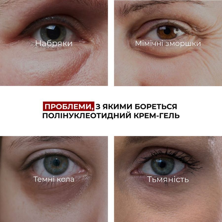 Полінуклеотидний крем-гель для сяйва шкіри навколо очей Hillary PDRN Eye Cream-Gel with Caffeine & Peptides, 12 мл - фото №1