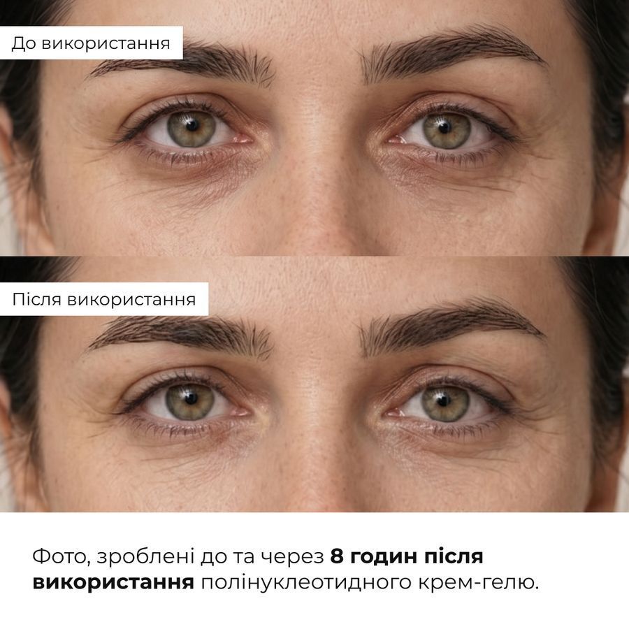 - фото №1
