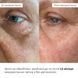 Набір для зменшення зморшок і темних кіл навколо очей Hillary Wrinkle & Dark Circle Correction Set - фото