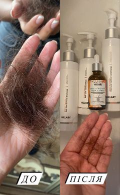 Комплекс проти випадіння волосся Hillary Serenoa & РР Hair Loss Control - фото №1