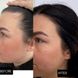 Шампунь + Cыворотка против выпадения волос Hillary Serenoa & РР Hair Loss Control - фото