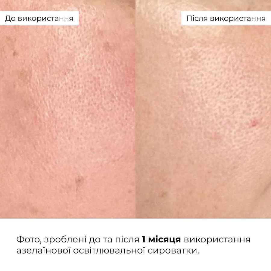 Комплекс для освітлення пігментації та захисту шкіри обличчя Hillary Pigmentation Brightening & Face Skin Protection Complex - фото №1