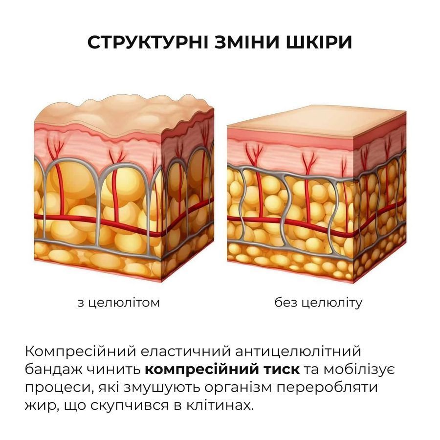Антицелюлітні моделюючі обгортання для тіла з ніацинамідом Hillary Niacinamide Cold Slim - фото №1