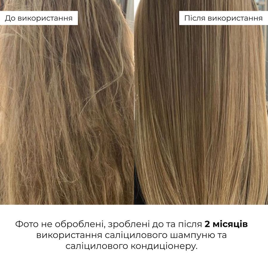 Комплекс для глибокого очищення та оновлення шкіри голови Hillary Deep Scalp Cleansing & Renewal Complex - фото №1