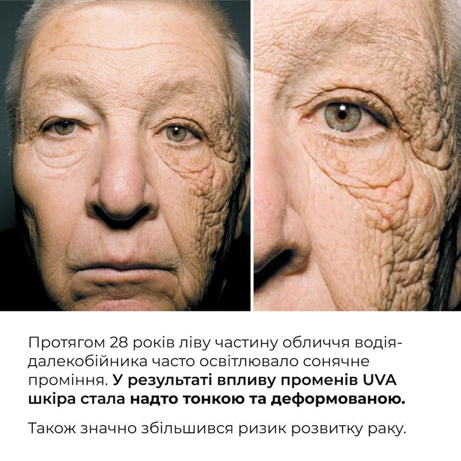 Hillary Azelaic & Vitamin C Brightening & SPF Protection Set