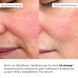 Комплекс базового догляду для оновлення та захисту шкіри Hillary Basic Care Skin Renewal & Protection Set - фото