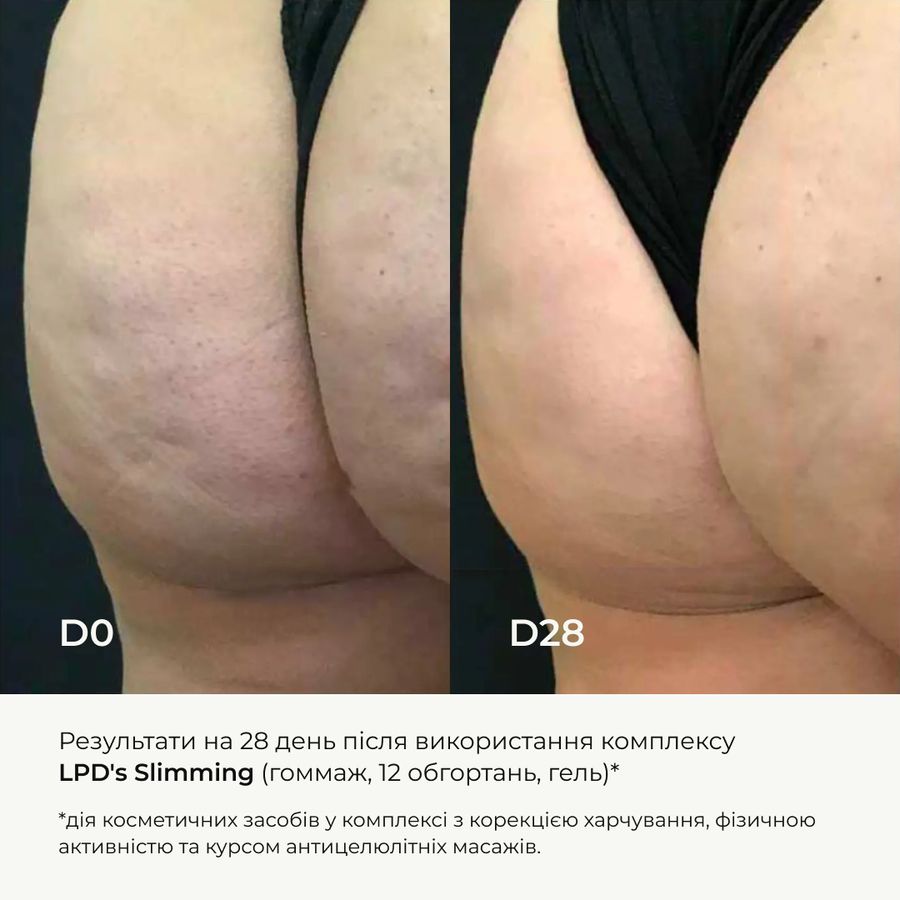 Course for anti-cellulite care at home with active liposomal anti-cellulite complex Hillary LPD'S Slimming
