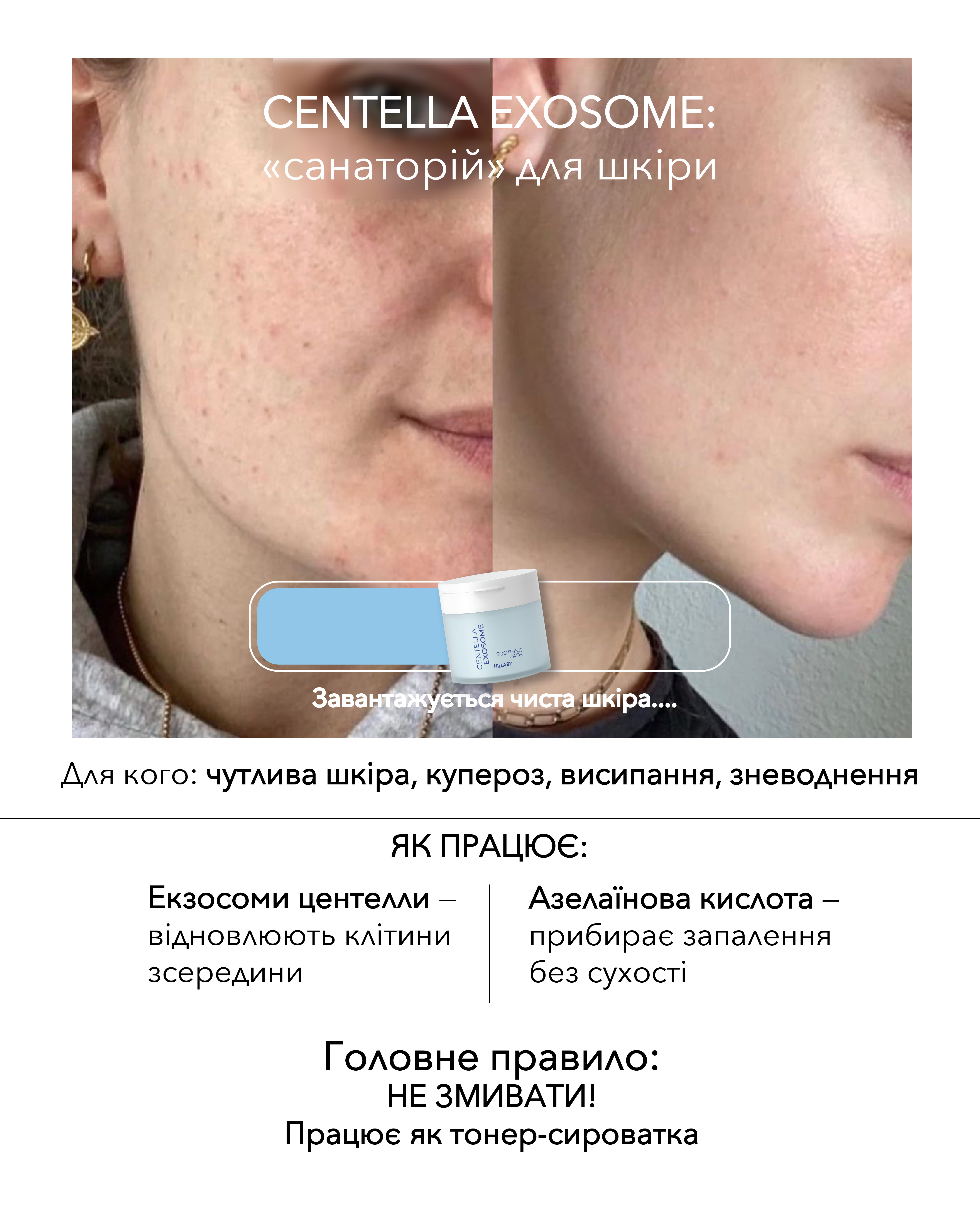 Тонер-педи: тренд чи необхідність? - Hillary Cosmetics