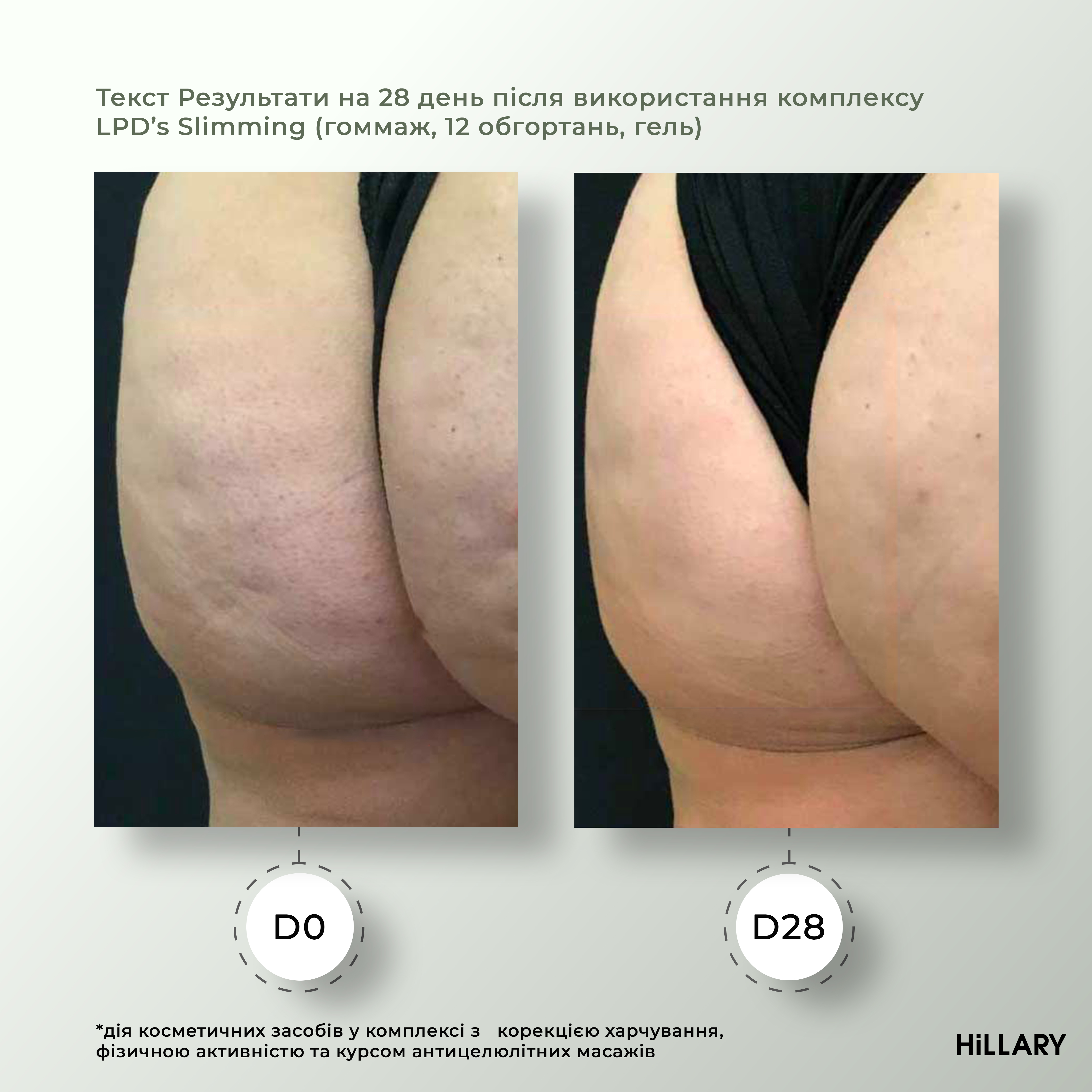 Набір Антицелюлітні ліпосомальні обгортання + рідина Hillary Anti-cellulite LPD'S Slimming (6 процедур)