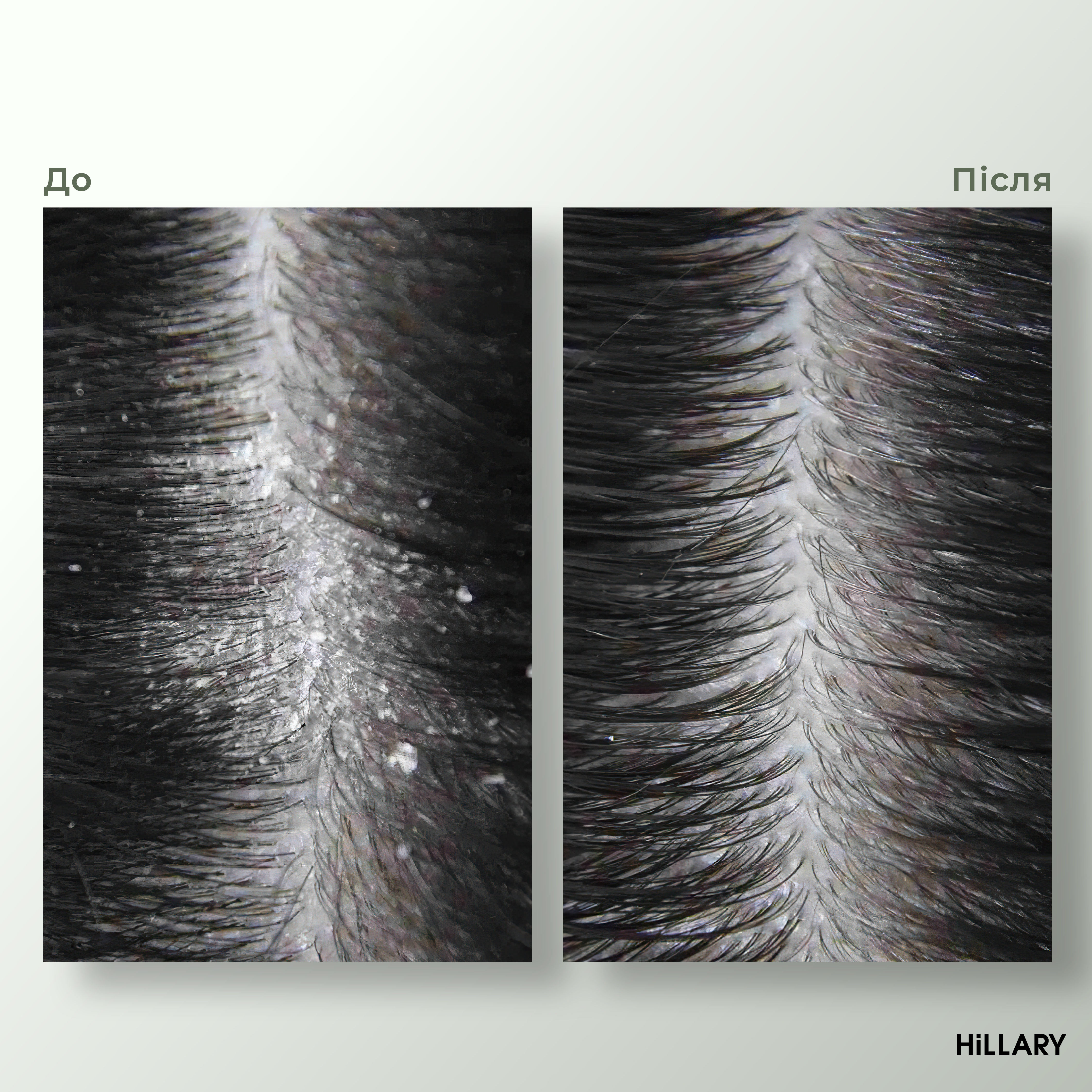 Ензимний пілінг для шкіри голови + Комплекс для росту волосся Hop Cones & B5 Hair Growth Invigorating